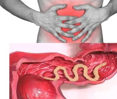 Ανθρώπινα παράσιτα