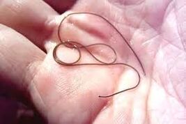 Παράσιτο στην παλάμη σας