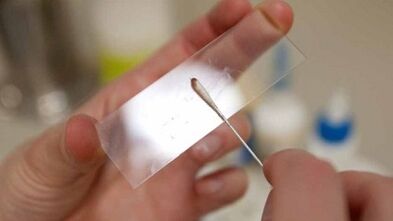 Ανάλυση Calais για τον εντοπισμό των παρασίτων