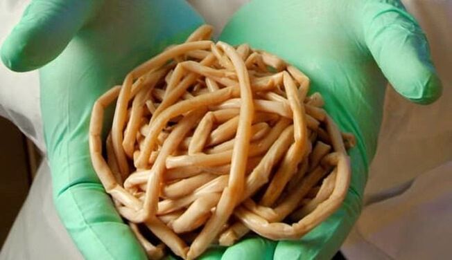 Απομάκρυνση παρασίτων από το σώμα